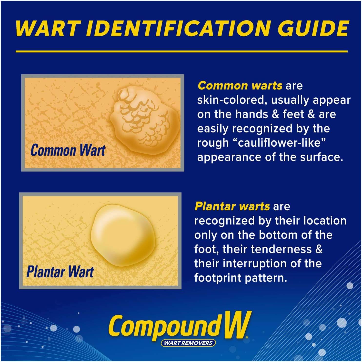Compound W Freeze Off, Maximum Strength Wart Removal System, For Removal of  Common Warts and Plantar Warts, 12 Treatments - Care and Shop